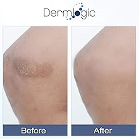 Dermlogic Vitamin K Cream with Arnica, 5.29oz — image 4