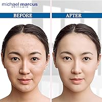 Michael Marcus Exfoliating Enzyme Face Peel 1.7oz — image 6