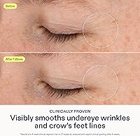 Skinfix Triple Lipid-Boost 360 Eye Cream 0.5 fl oz — image 3