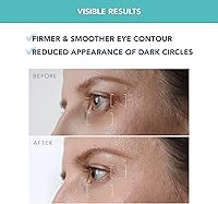 Foreo IRIS Firming PM Eye Serum - 0.5 oz — image 4