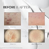 VT COSMETICS Reedle Shot Compact Set 100/300/700 (10mL each) — image 3