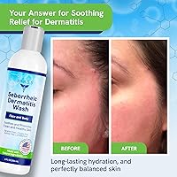 pHat 5.5 Seborrheic & Atopic Dermatitis Face Wash 8oz — image 6