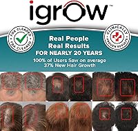 iGrow Laser Hair Growth System — image 2