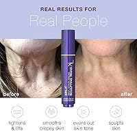 SBLA Neck, Chin & Jawline Sculpting Wand XL — image 2