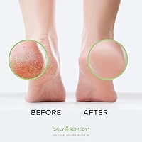 Daily Remedy Extra Strength Tea Tree Oil Foot Soak with Epsom Salt - 2 Pack — image 6