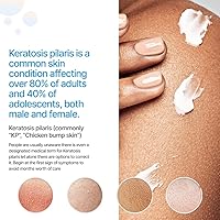 KP Essentials Keratosis Pilaris Exfoliating Cream 4oz — image 2