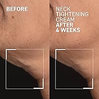 Dr. Brandt Needles No More Neck Tightening Cream 1.7oz — image 4