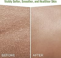 Wild Naturals Moisturizing Eczema Body Wash — image 10