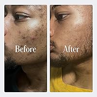 Geologie Complete Skincare Set for Men & Women — image 8