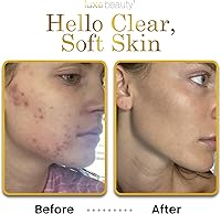 Luxe Beauty Unscented Luxury Lotion 8.5oz — image 5