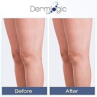 Dermlogic Vitamin K Cream with Arnica, 5.29oz — image 3