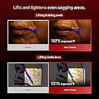 MEDITHERAPY Wrinkle-fit Mask + Facial Roller 7 Pack — image 5