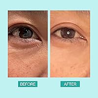 eb5 Daily Repair Eye Treatment 0.5oz — image 6