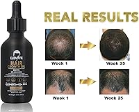 Elevate Hair Regrowth Treatment 5% Minoxidil Solution 2oz — image 5