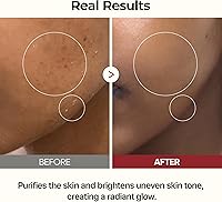 Dr.Melaxin Peel Shot Glow Rice Toner 200mL — image 6