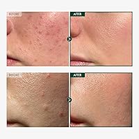 TOSOWOONG Madagascar Centella 86% Ampoule 100mL — image 2