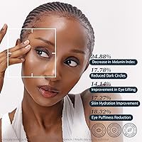 Re.SPN Bakuchiol Firming Eye Cream with Cooling Metal Roller – 0.67oz — image 6