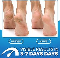 Imperial Feet 2 in 1 Foot Cream for Dry Cracked Heels 2.5oz — image 2