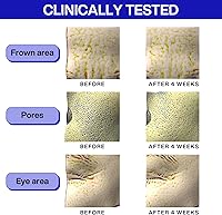 IOPE Retinol Super Bounce Serum 1.01 Fl Oz — image 7