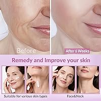 VicGFHS Neck Firming Cream with Collagen & Hyaluronic Acid, 1.7oz — image 2