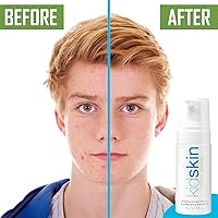 Kidskin T-Blast Facial Cleanser 150mL — image 5