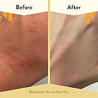 ECZEMA HONEY Oatmeal Body Lotion 16oz — image 4