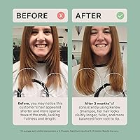 ACTIIV Renew Healing Shampoo Treatment 6oz — image 5