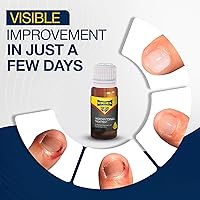 URIEL Ingrown Toenail Treatment 20ml — image 2