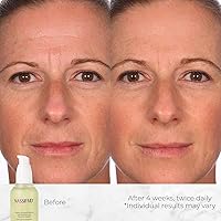 NassifMD Hydro-Screen Hydration Serum 1oz — image 3