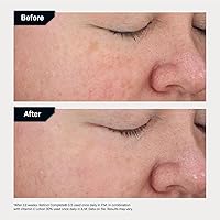 Revision Skincare Vitamin C Lotion 1oz — image 5