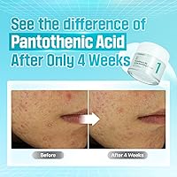 numbuzin No.1 Pantothenic B5 Active Soothing Cream 2.7oz — image 4