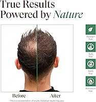 Kreyol Essence Scalp Care Pomad, Rosemary Peppermint 4oz — image 4