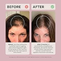 ACTIIV Recover Thickening Shampoo Treatment for Women, 2oz — image 6