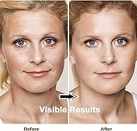 Lefay Face Skin Tightening Machine RM — image 6