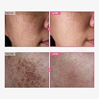 TOSOWOONG Arbutin 7% + Tranexamic Acid 4% Cream 50mL — image 2