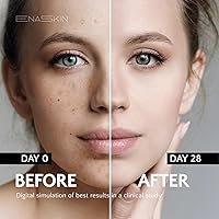 EnaSkin Dark Spot Remover Serum 1.0 Fl Oz — image 3