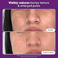 Paula's Choice Clinical 20% Niacinamide Serum, 0.67oz — image 4