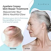 Ayadara Crepey Skin Repair Treatment 8oz — image 3
