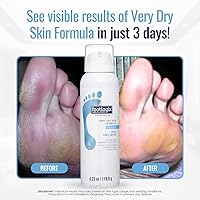 Footlogix Very Dry Skin Formula 3.2oz — image 3