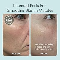 Beautiste 30 Day Miracle AHA 30% + BHA 2% Peeling Solution — image 7