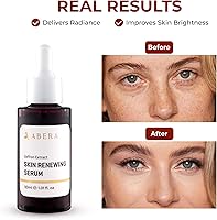 ABERA Saffron Serum for Melasma Treatment, 1.01 Fl Oz — image 4