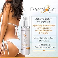Dermlogic Anti-Acne Thigh & Buttocks Treatment 6.09oz — image 2