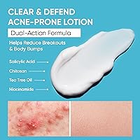 AOBBIY Butt Acne Clearing Treatment Cream, 4.97oz — image 3