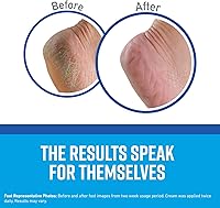 O'Keeffe's Healthy Feet Foot Cream 3oz (4 Pack) — image 3