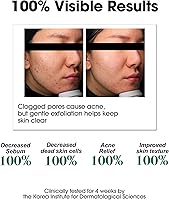 SOME BY MI AHA BHA PHA 30 Days Miracle Toner – Pack of 2 — image 4