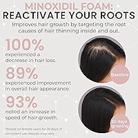 Minoxidil for Women 5% Hair Regrowth Treatment Foam 3-Month Supply — image 2