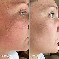 Three Ships SkinHero Calendula + 2% Bakuchiol Bio-Retinol Serum 1oz — image 4