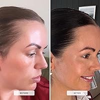 HAIR BURST Shampoo and Conditioner Set Coconut & Avocado — image 6