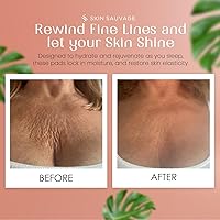 Skin Sauvage Chest and Neck Wrinkle Pads — image 4