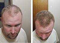 Caboki Hair Loss Concealer Light Brown 30G — image 5